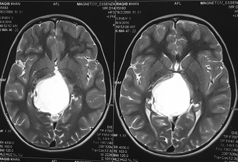 Fig 3b