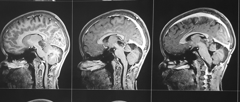(Fig 4a)