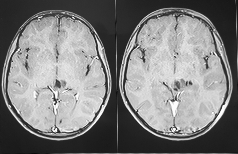 (Fig 4b)