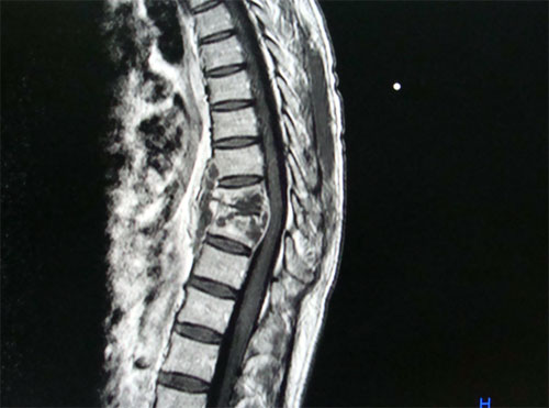 Spine