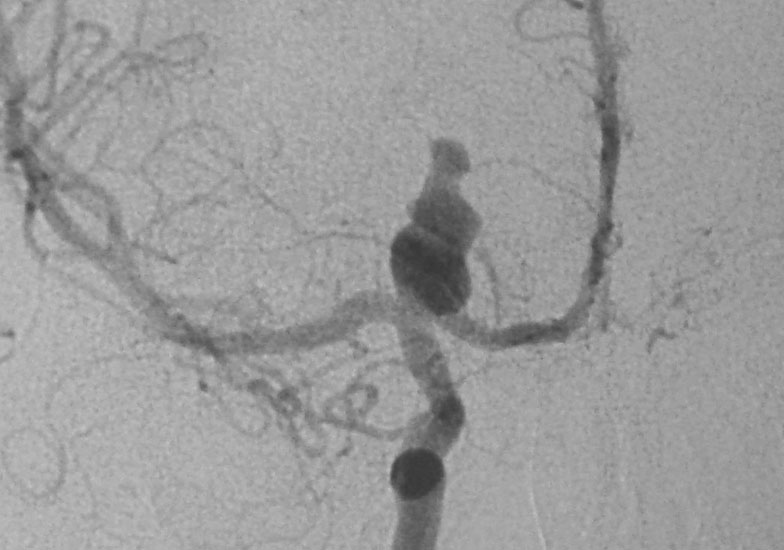 Fig 3